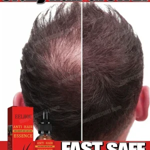 Hair Growth Essential Loss Regrowth Treatment Strengthens Hair Nourishes Scalp Light Weight Non Greasy Improve Scalp Circulation