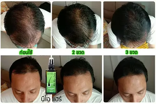 120ml Ne Hair Lotion Hair Root HAIR BEARD SIDEBURNS LONGER Herbs Treatment 100% Original Thailand Free Gift - Image 3