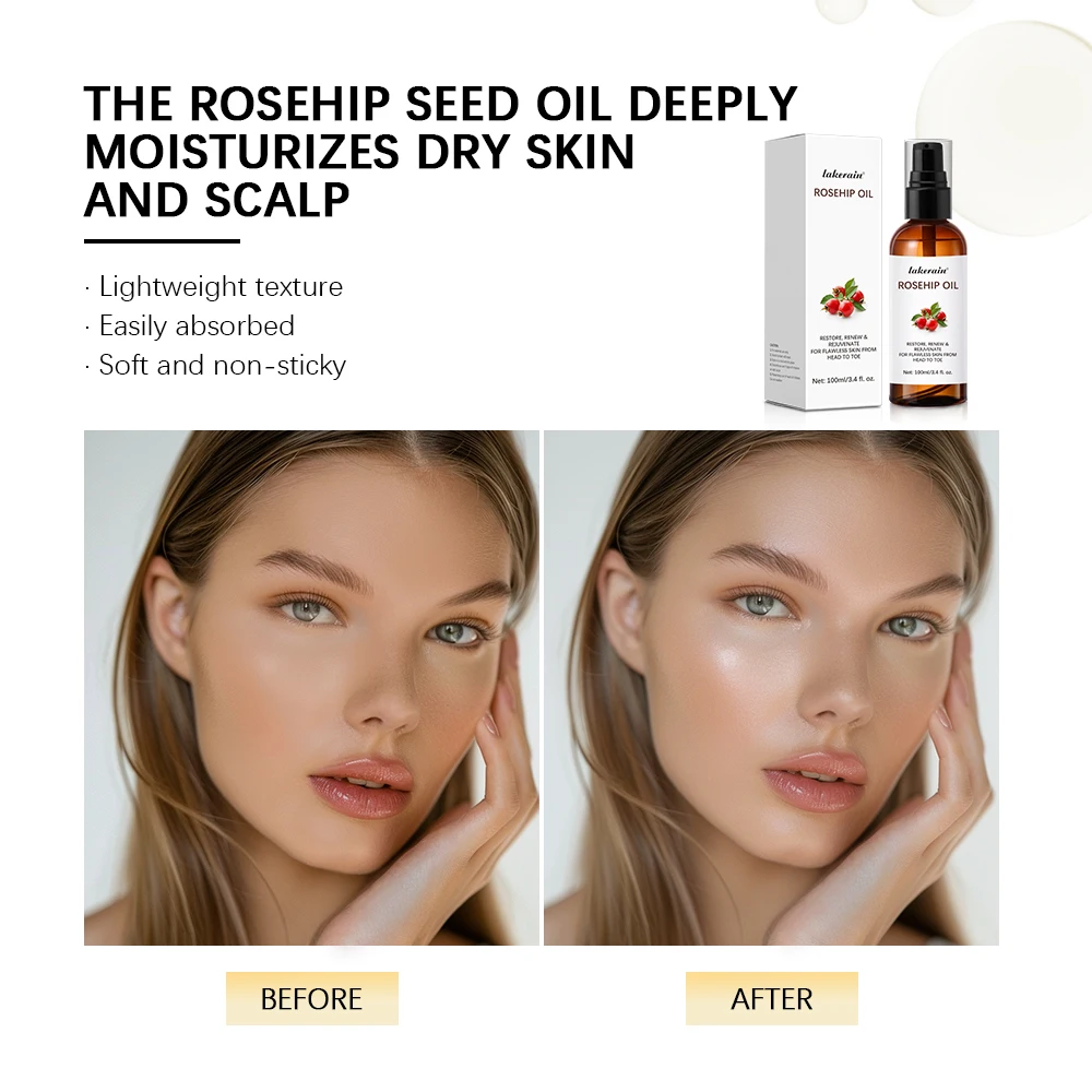 Organic Rosehip Oil Rose Hips Face Oils 30ml Fast-Absorbing Skin Care Moisturizer Face Oil Organic Rosehip Seed Oil Essence - Image 6