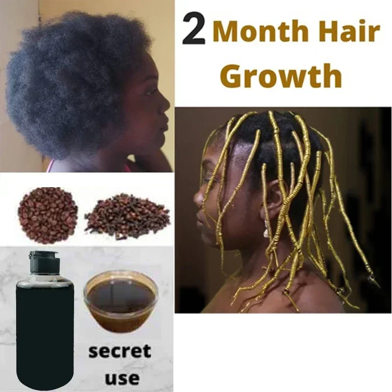 300ml Super Fast Hair Growth Shampoo Combining Africa Chad Chebe Powder Local Ingredients with Polygonum multiflorum - Image 2