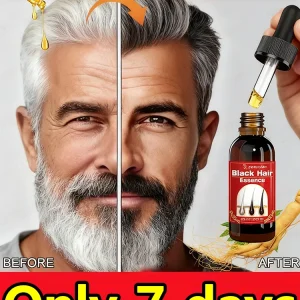 Amazing Hair Color Restoration Serum - Returns Natural Black in 7 Days, No Ammonia, Safe & Gentle