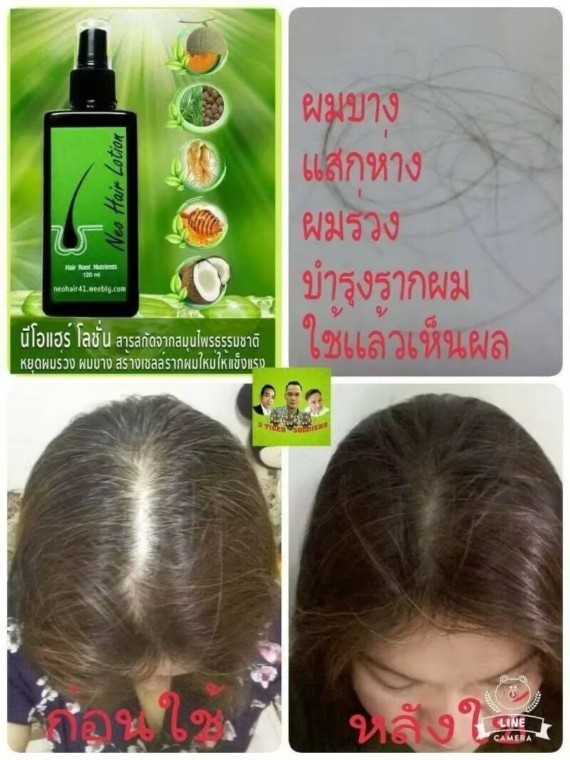 120ml Ne Hair Lotion Hair Root HAIR BEARD SIDEBURNS LONGER Herbs Treatment 100% Original Thailand Free Gift - Image 4